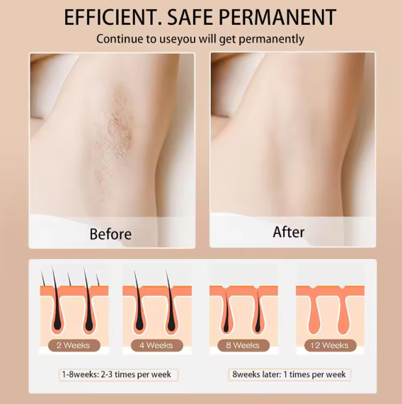Babyverse - Digital IPL Hair Removal Device ©